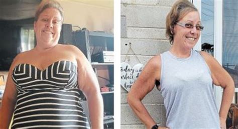 Ernie Schramayr Grimsby Mother Turned To Gastric Bypass Surgery To Get