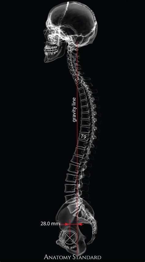 Sagittal Vertical Alignment Of The Spine Artofit