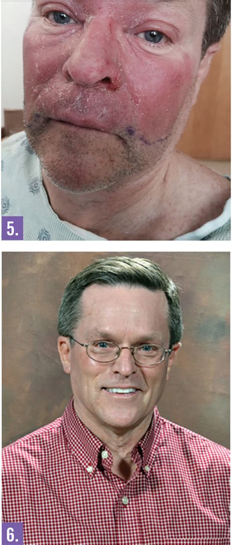 What Is Causing This Edematous Facial Deformity Consultant360