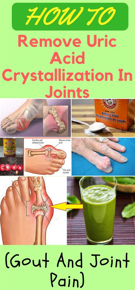 Run Healthy Lifestyle How To Remove Uric Acid Crystallization In