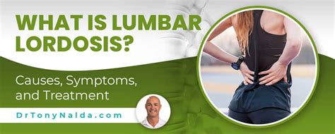 What Is Lumbar Lordosis Causes Symptoms And Treatment