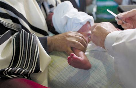 An Open Wound The Heated Debate Surrounding Circumcision The Jerusalem Post