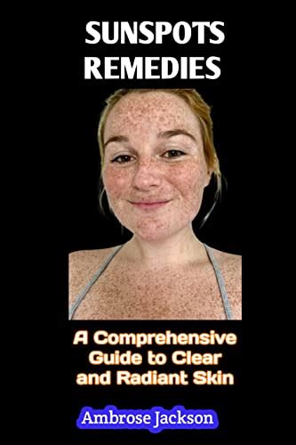Sunspots Remedy Tips A Comprehensive Guide To Clear And Radiant Skin By Ambrose Jackson