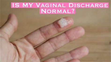 What Does The Discharge Look Like When You Have A Yeast Infection