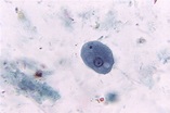 Public Domain Picture | Entamoeba coli trophozoite with ingested ...