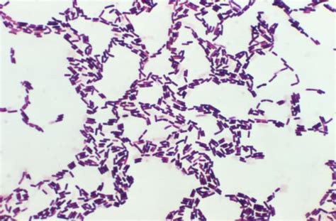 Bacillus Coagulans Wikipedia