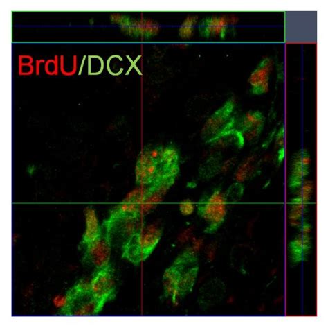 Brdu Dcx Positive Cells In The Dg And Svz Detected By Confocal