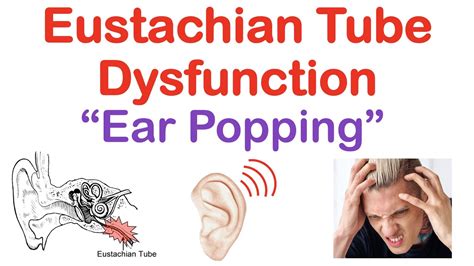 Eustachian Tube Dysfunction Popping Sound In Ears Causes