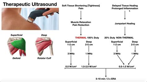 Therapeutic Ultrasound Explained Use Parameters And Real Example
