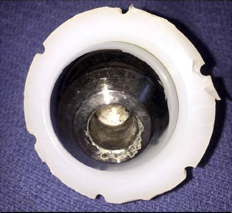 Corrosion Of Chromium Cobalt Head In Metal On Plastic Mop Hip
