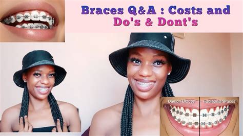 Braces Cost In South Africa Prices From Different Orthodontists Youtube