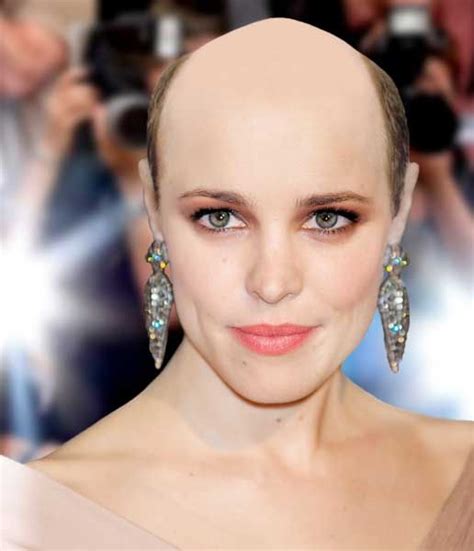 Going Bald Celebrities Female Balding