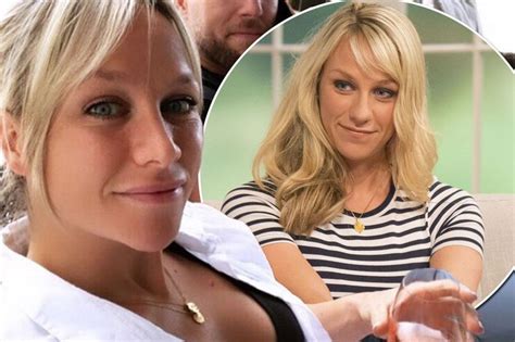 Chloe Madeley Reveals Getting Puffy Lip Filler Is Her Biggest Regret As She Admits Sex Ban