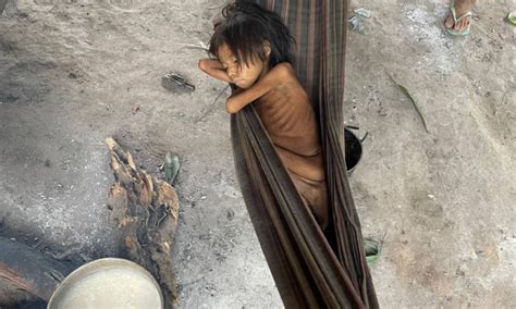Foto de criança em Roraima expõe crise na assistência à saúde dos yanomamis