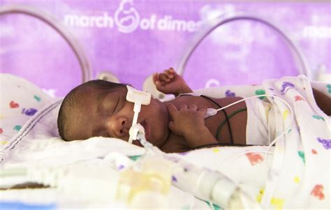 1 Month Premature Baby Development Newborn Baby