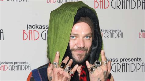 Bam Margera Star Of ‘jackass On Ventilator With Pneumonia Report