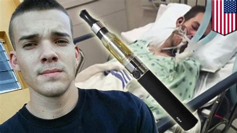 E Cig Explosion Florida Man In Coma After E Cigarette Explodes In His