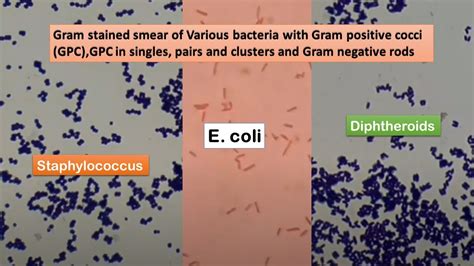 Staphylococcus E Coli And Diphtheroids In Gram Stained Smear Of