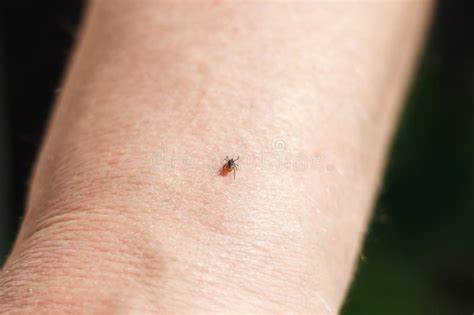 Danger Of Tick Bite Shows Close Up Mite In The Hand Stock Image