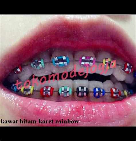Kumpulan gambar untuk Belajar mewarnai: gambar karet behel