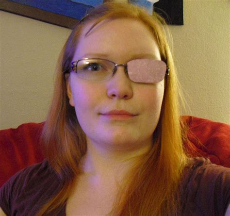 Drpatch Eye Patches Review Emily Reviews