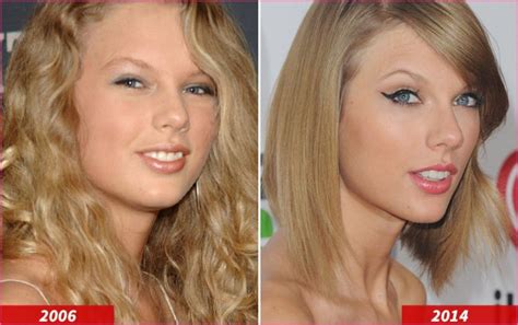 Taylor Swift Plastic Surgery Before And After Many People Are Lately Talking About The