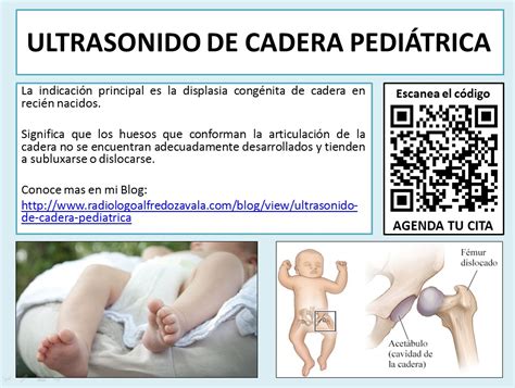 ultrasonido de cadera pediatrica