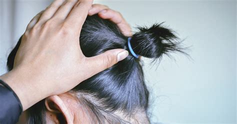 If hair loss is caused by an illness, treatment of the illness is the best treatment for hair loss. Laser Treatment for Hair Loss: Does It Work?
