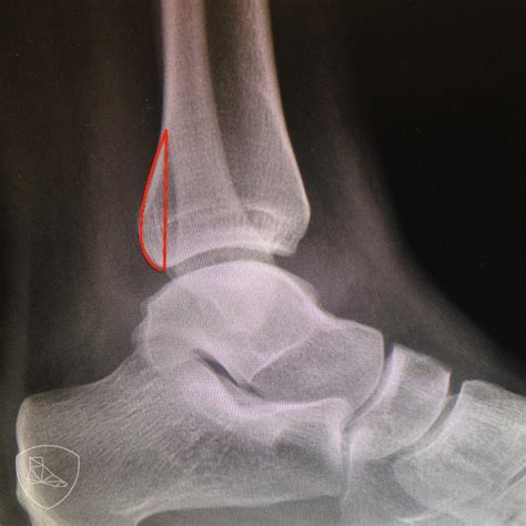 Simple Science: How to Make a Volcano with Kids