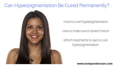 How To Treat Hyperpigmentation Topical Creams Peels Laser Therapy And