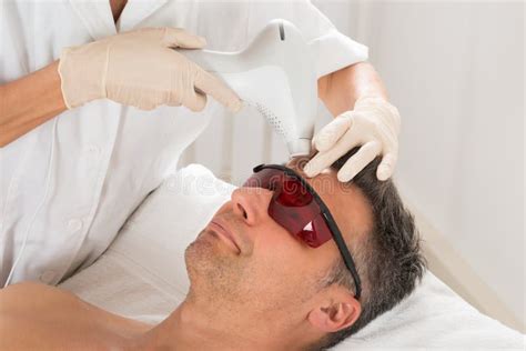 Man Receiving Laser Epilation Treatment Stock Image Image Of Hair
