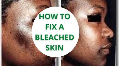 How To Repair A Damaged Bleached Skin What You Should Do If You