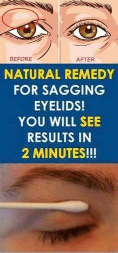 Natural Remedy For Sagging Eyelids How To Fix Droopy Eyelids Instantly How To Get Rid Of Hooded