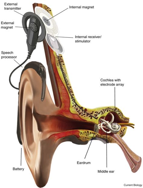 Internal Part