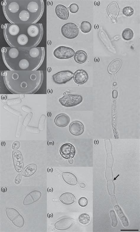 Morphology Of Basidioascus Persicus Ibrc M30078 T Colonies On Mea A
