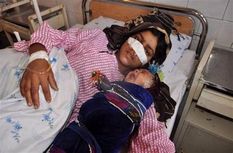 Afghan Womans Nose Is Cut Off By Her Husband Officials Say The New York Times