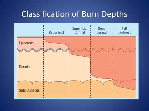 Classification Of Burn Injury Classification Burns Thermal Injuries