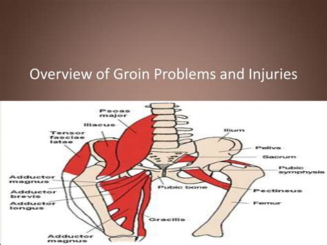 Ppt Groin Injuries And Problems Powerpoint Presentation Free