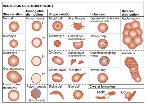 Rbc Morphology Microcytic Anemia Medical Lab Technician Clinical