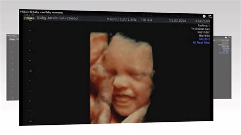 Amazing 4d Scan Done At Our Clinic Call 08000075076 Baby Scan 4d