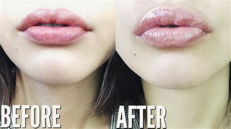 How To Get Bigger Lips Without Makeup Or Surgery Mugeek Vidalondon