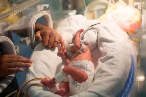 Miracle Babies Born Four Months Early Are Living Proof That Premature