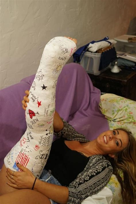 how to make a leg cast for halloween ann s blog