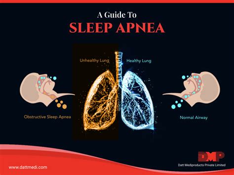 obstructive sleep apnea blog by datt mediproducts