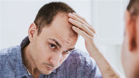 Why Is My Hair Falling Out Hair Loss Causes And Treatments Opt Health