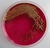 Escherichia coli Free Photo Download | FreeImages