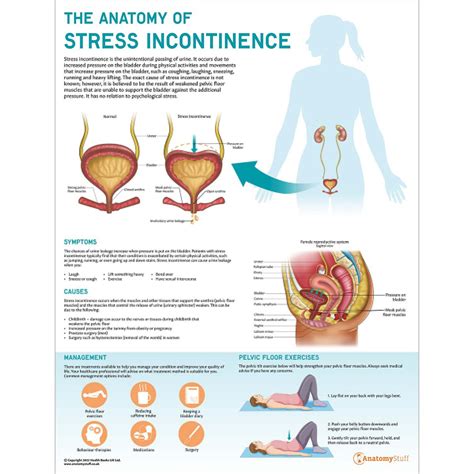 The Anatomy Of Stress Incontinence Urology Chart Anatomy Stuff