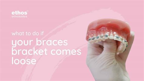 What To Do If Your Braces Bracket Comes Loose Ethos Orthodontics