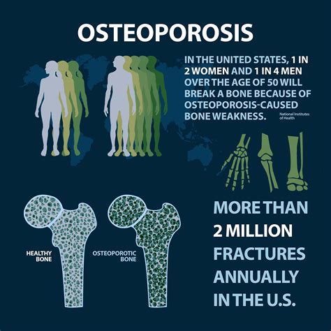 Osteoporosis Florida Orthopaedic Institute