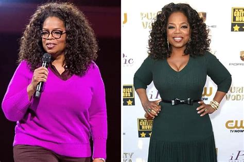 Celebrities Who Had Gastric Sleeve Surgery Before And Afters